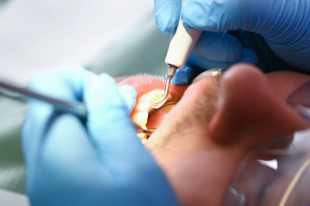 Best Emergency Treatment for Toothache in White Salmon, WA
