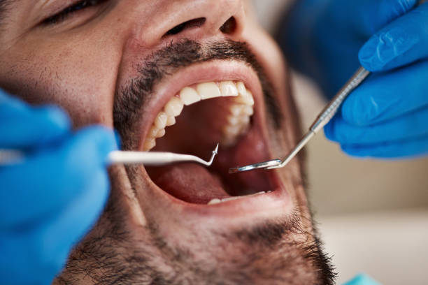 Best Emergency Broken Tooth Repair in White Salmon, WA
