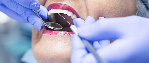 Best Emergency Tooth Extraction in White Salmon, WA